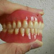 لابراتوار دندانسازی ساخت دندان مصنوعی ژله ای
