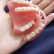 پروتز دندان