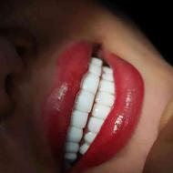 ترمیم دندان با کامپوزیت جنس سولافیل سارامکو وکاریزما