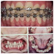 خدمات تخصصی دندانپزشکی
