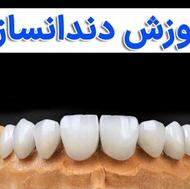 آموزش دندانسازی آی دنتال لب