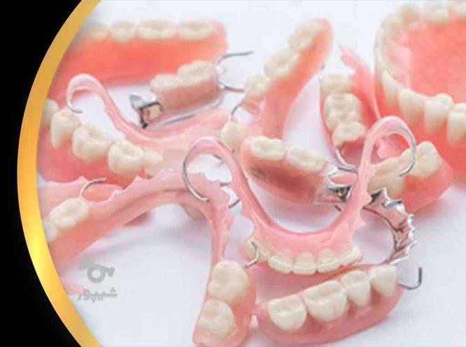 دندانسازی بختیاری (دندان مصنوعی ) ساخت دست دندان بابیمه