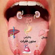 تشخیص عارضه های بدن با زبان