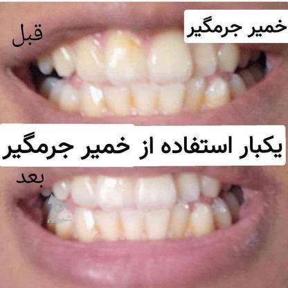 جرم گیر قوی و فوری دندان در گروه خرید و فروش لوازم شخصی در اصفهان در شیپور-عکس1