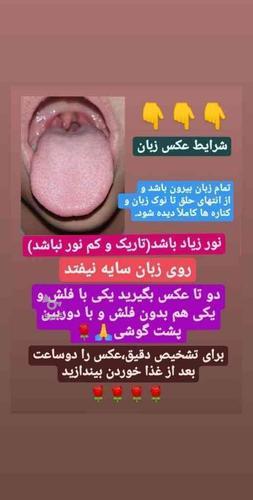 درمان بیماریهااز زبان