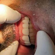تخفیف 50 درصدی خدمات دندانپزشکی به مناسبت محرم