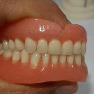 لابراتوار دندانسازی ساخت دندان مصنوعی متحرک تضمینی