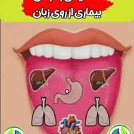 تشخیص مشکلات از روی زبان شما