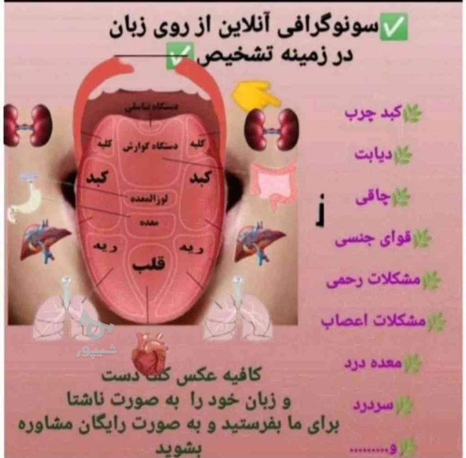 کسب مهارت درکنار درآمد با طب سنتی برای خانم ها در گروه خرید و فروش خدمات و کسب و کار در تهران در شیپور-عکس1