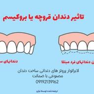 لابراتوار دندانسازی دندان مصنوعی ژله ای نرم و راحت اوردنچر