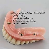 ساخت اوردنچر ایمپلنت بی واسطه تضمینی با قیمت کارگاهی