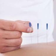 طب سوزنی صد درصد تضمینی