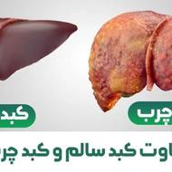 پاکسازی کبد فقط در 40روز
