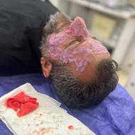 پاکسازی صورت اقایان و خانم ها