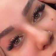 کاشت مژه هیدن