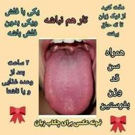 مزاج شناسی و تشخیص بیماری ها از روی عکس زبان