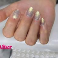 کاشت ناخن وژلیش