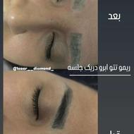 مرکز لیزروزیبایی دیاموند