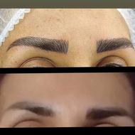 میکروبلیدینگ و میکروپیگمنتیشن ابرو و لب