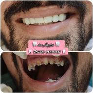 خدمات دندانپزشکی ،زیبایی،معاینه و مشاوره رایگان