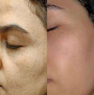 پوست صاف ویکدست میخوای متن آگهی روبخون+پیشنهادویژه