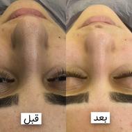 پاکسازی پوست