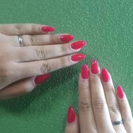 کاشت اولیه با ژل  