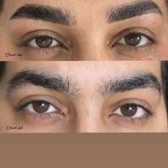 اصلاح با بند رایگان