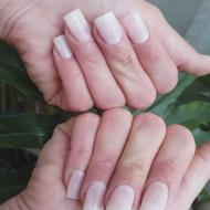 جذب مدل برای ترمیم و کاشت ژلیش