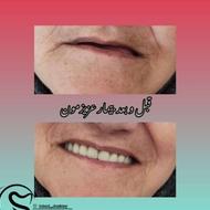 دندانسازی تخصصی بهزاد