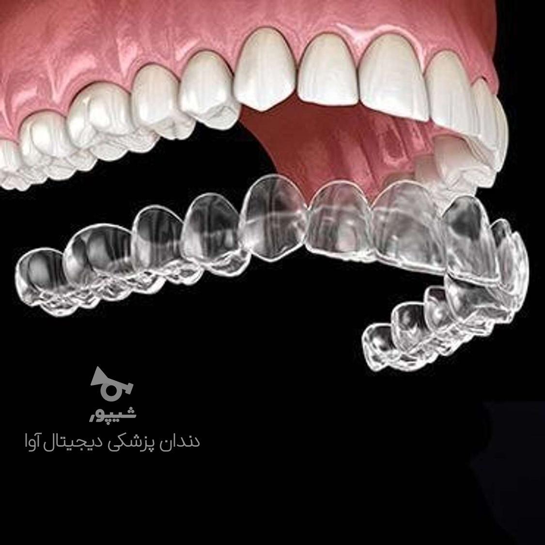 ارتودنسی آوا