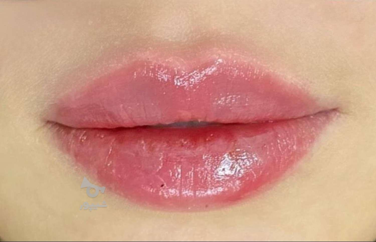 اجاره پروانه مطب زیبایی_ساری - undefined