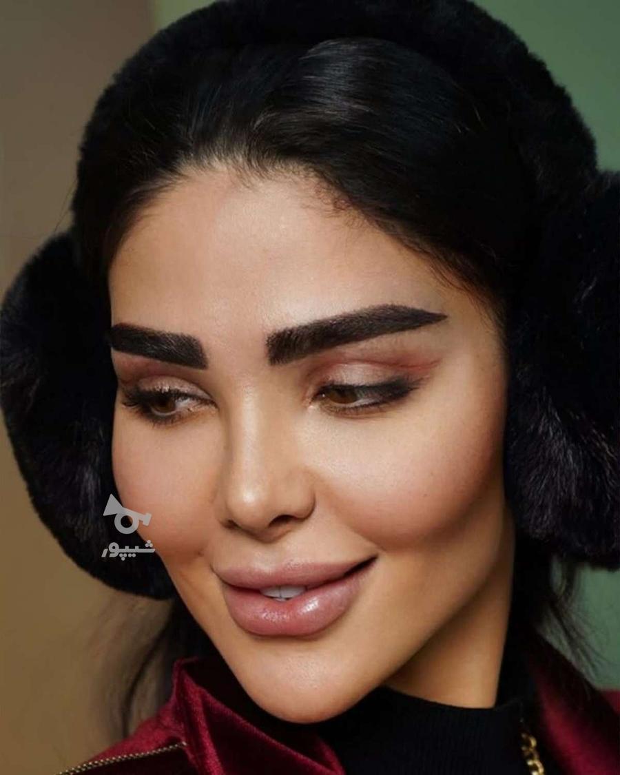 فیلر زیر چشم بوتاکس چشم گربه ای فیلر بادی ژل لب نخ لیفت ابرو