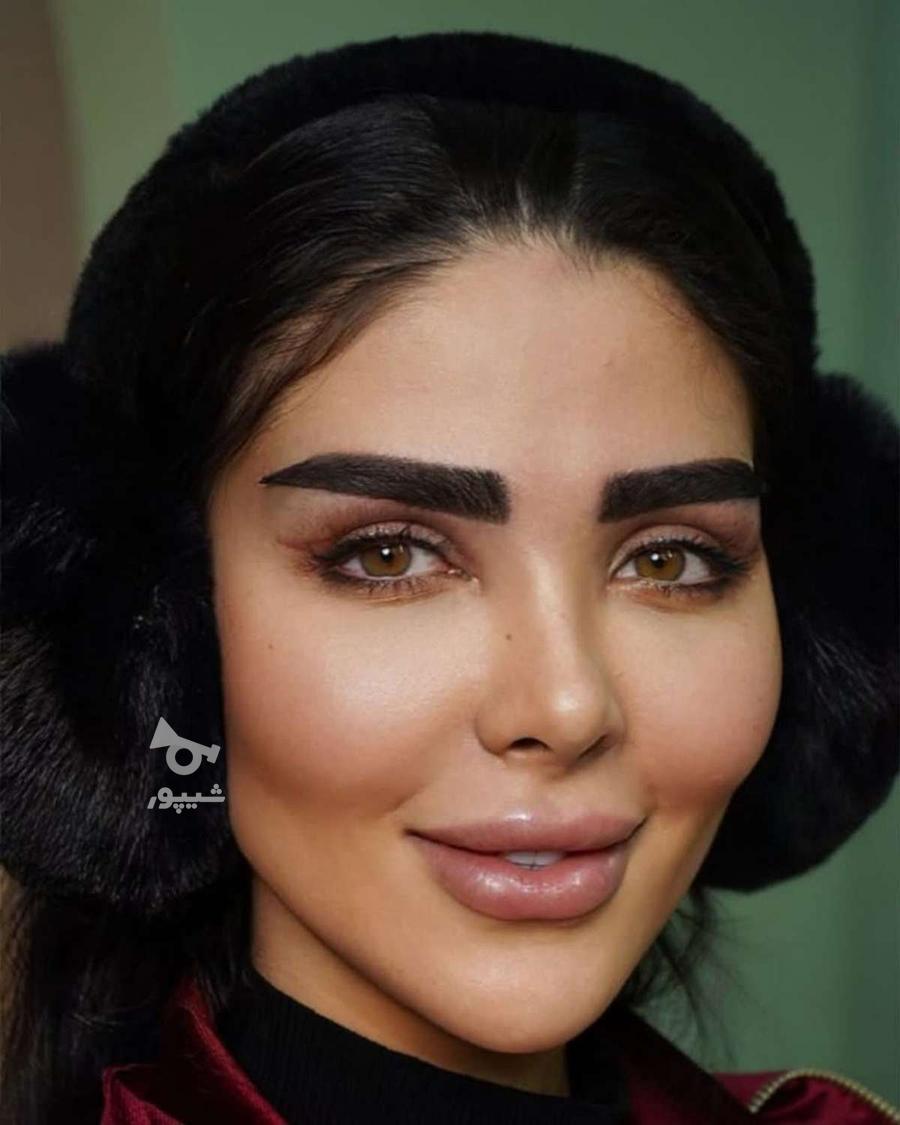 فیلر زیر چشم بوتاکس چشم گربه ای فیلر بادی ژل لب نخ لیفت ابرو