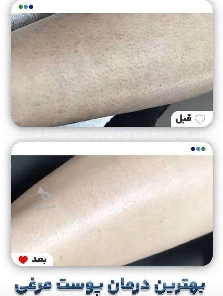 لیزر طول موج کندلا لیزر آقایان لیزر بانوان لیز کلاریتی