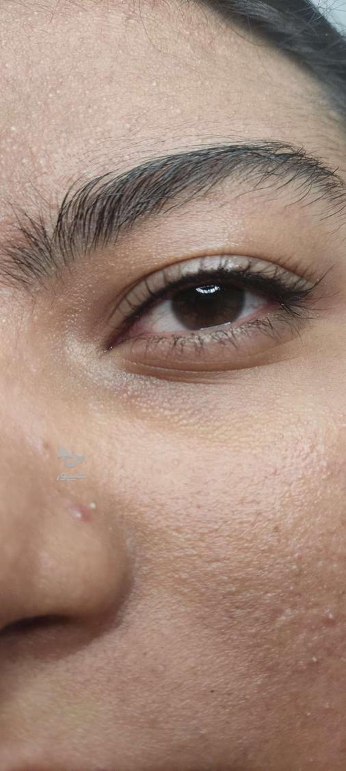 خدمات زیبایی فیبروز شیدینگ لب خط چشم و بن مژه.