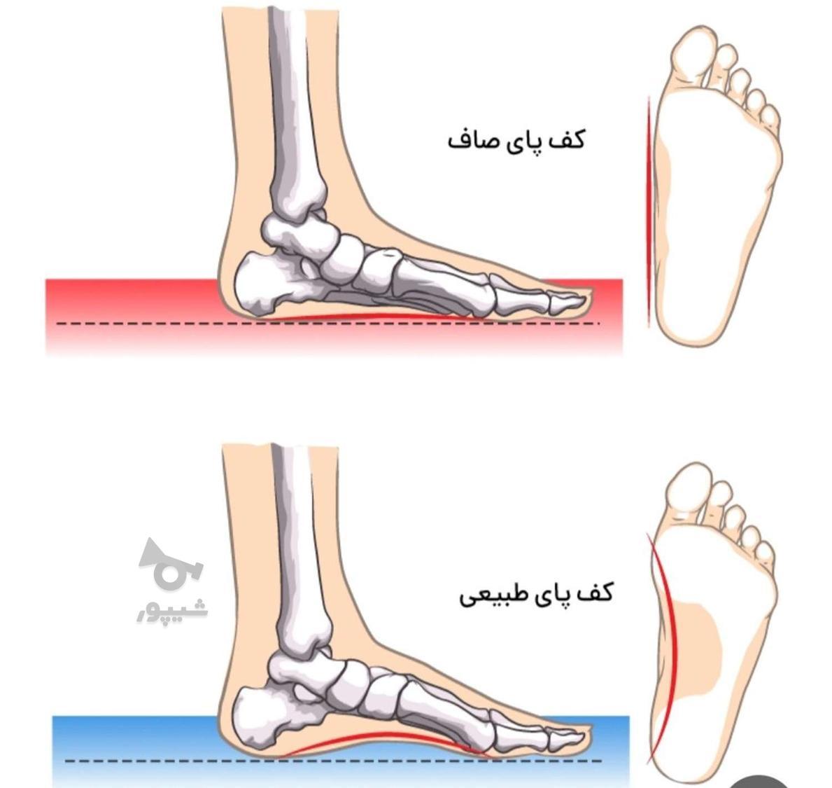 مرکز ارتوپدی درمان صافی کف پا
