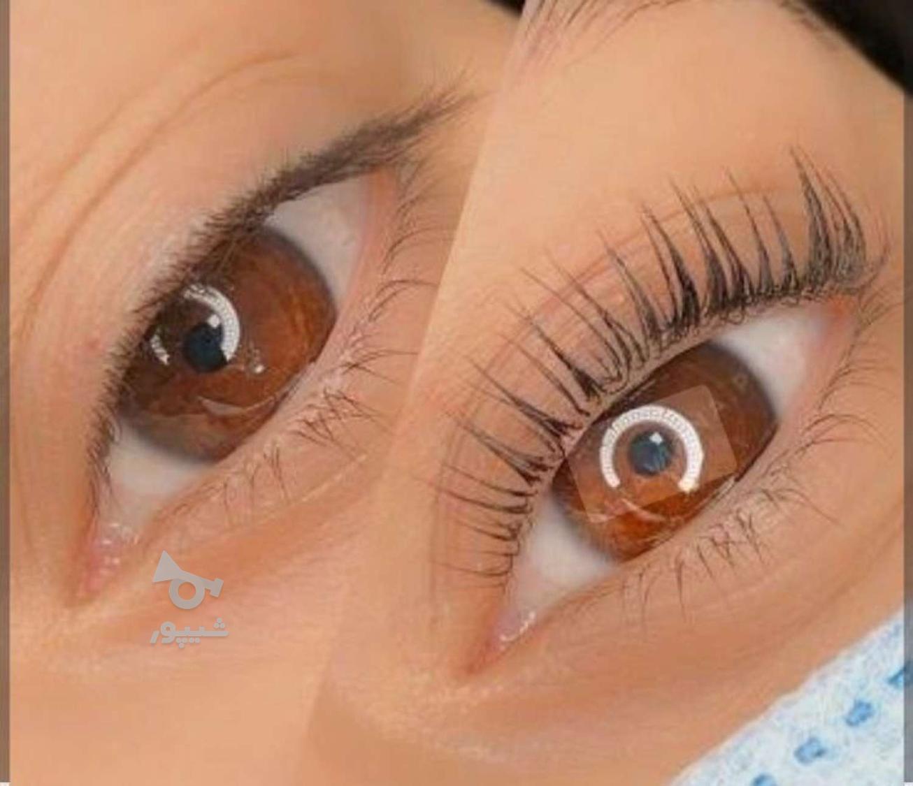 تخفیف ویژه لیفت لمینت