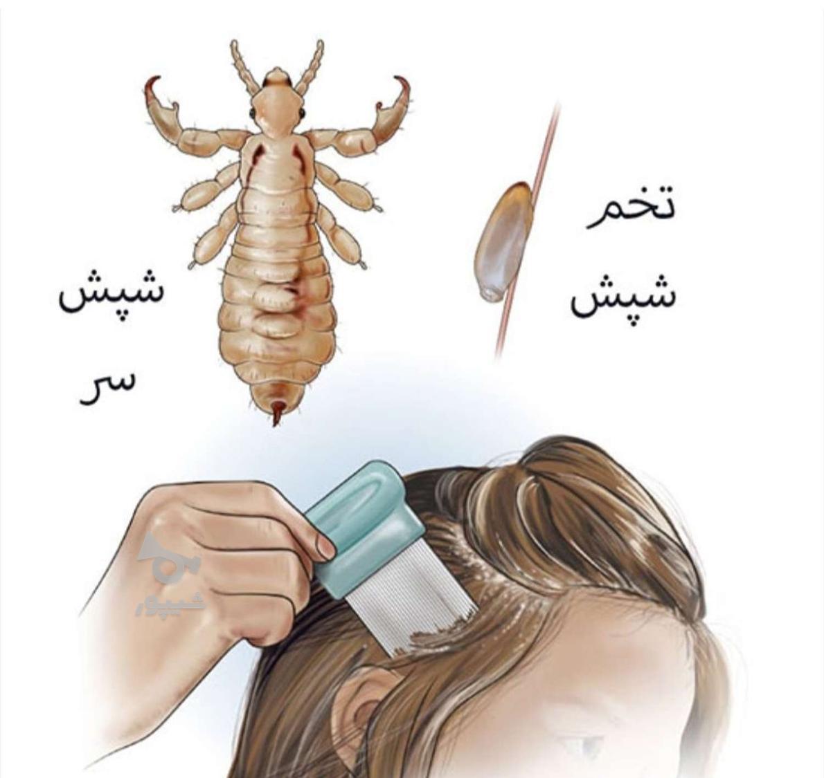 پاکسازی موـ فروش مواد گیاهی شپش- اسپره ی ضدعفونی کننده
