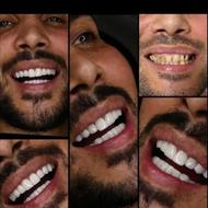 خدمات زیبایی دندانپزشکی لمینت نقد اقساط