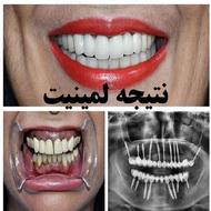 دندانپزشکی ایمپلنت+لمینت+کامپوزیت+ارتودنسی اقساط