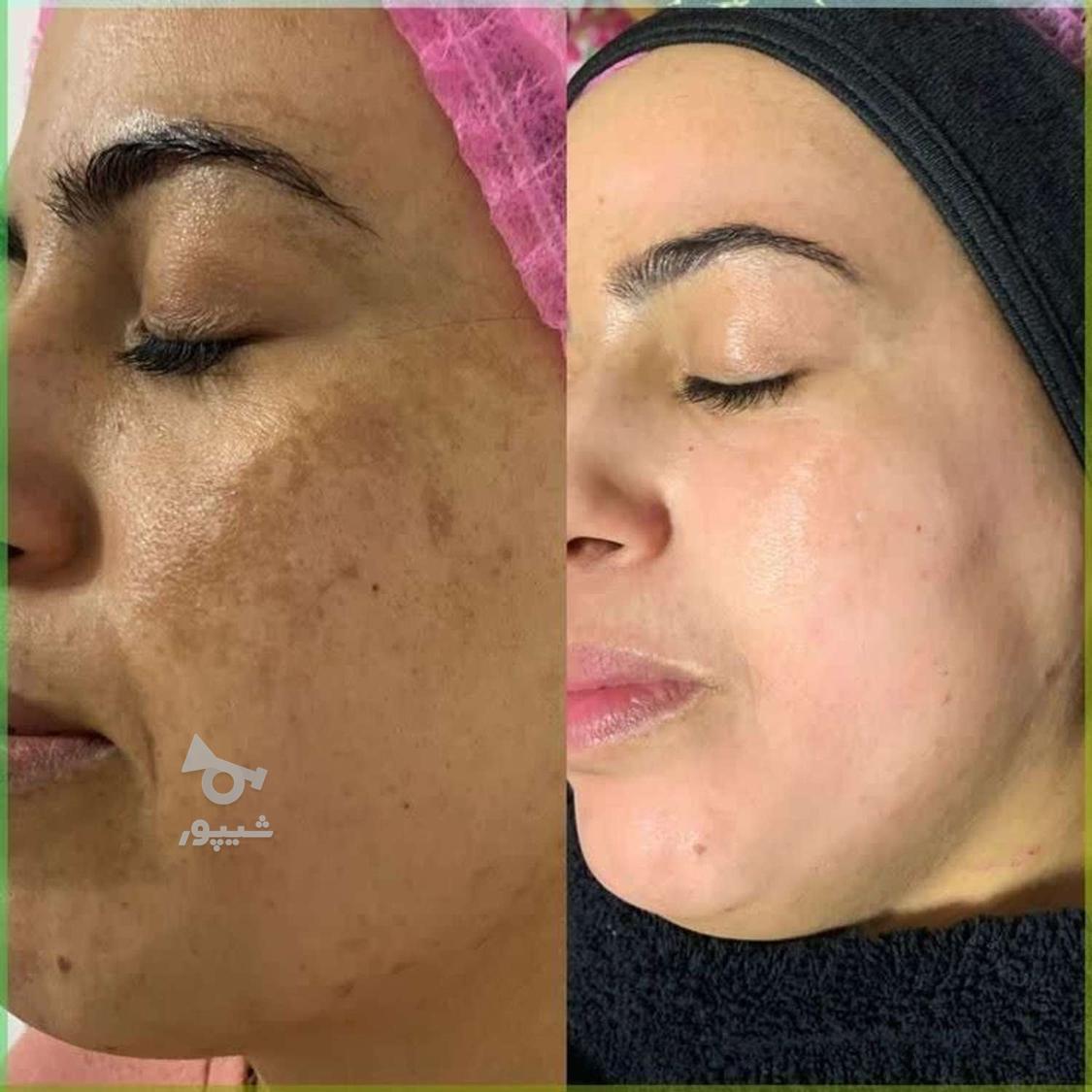 مرکز لیزر تهرانپارس