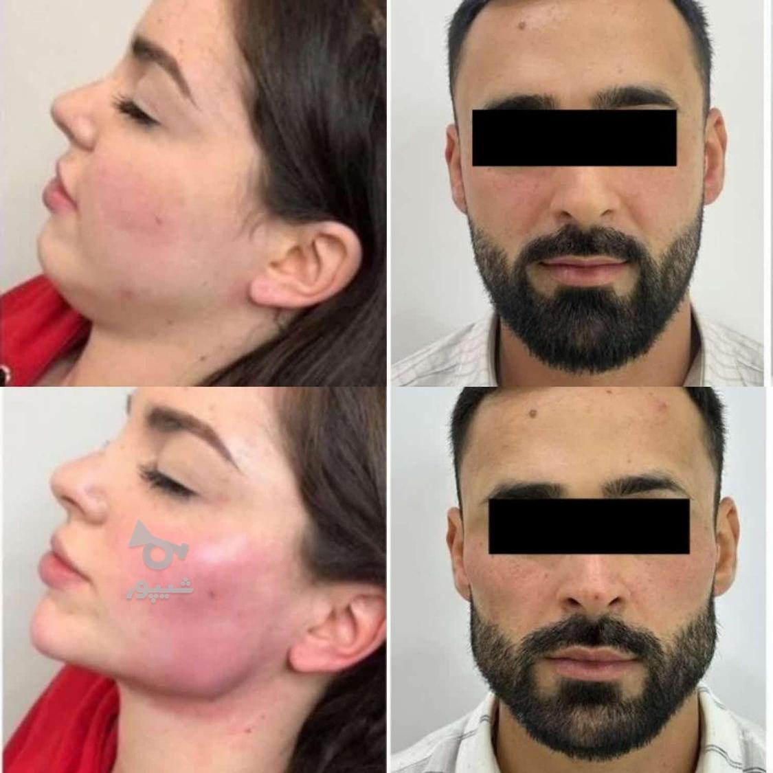 مرکز لیزر تهرانپارس