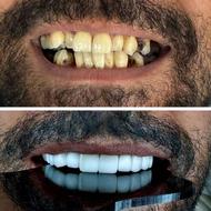 دندان پزشک قسطی زیبایی / عمومی / دندانپزشک / ایمپلنت ...