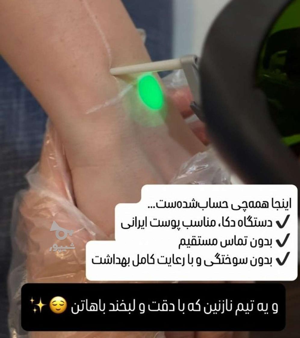 جشنواره ویژه لیزرموی‌زائد الکساندرایت دکا ایتالیا