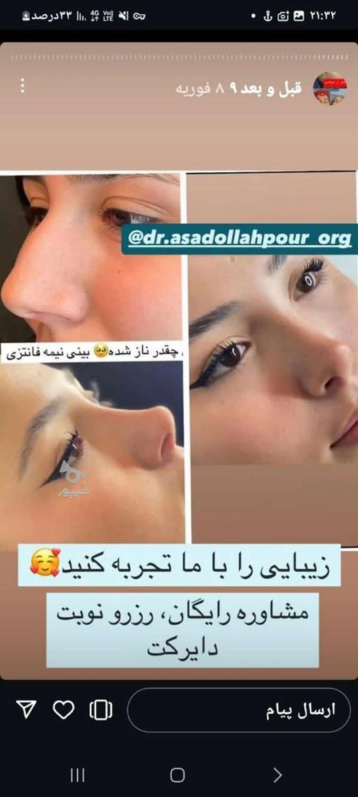 جراحی زیبایی بینی