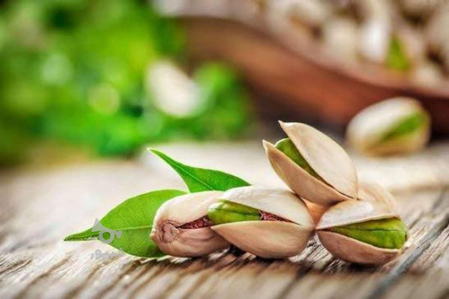 اکیپ پسته چینی کامل - undefined