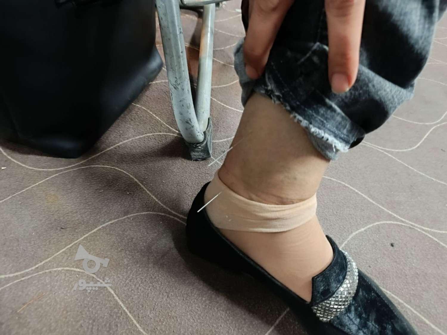 همایش طب سوزنی