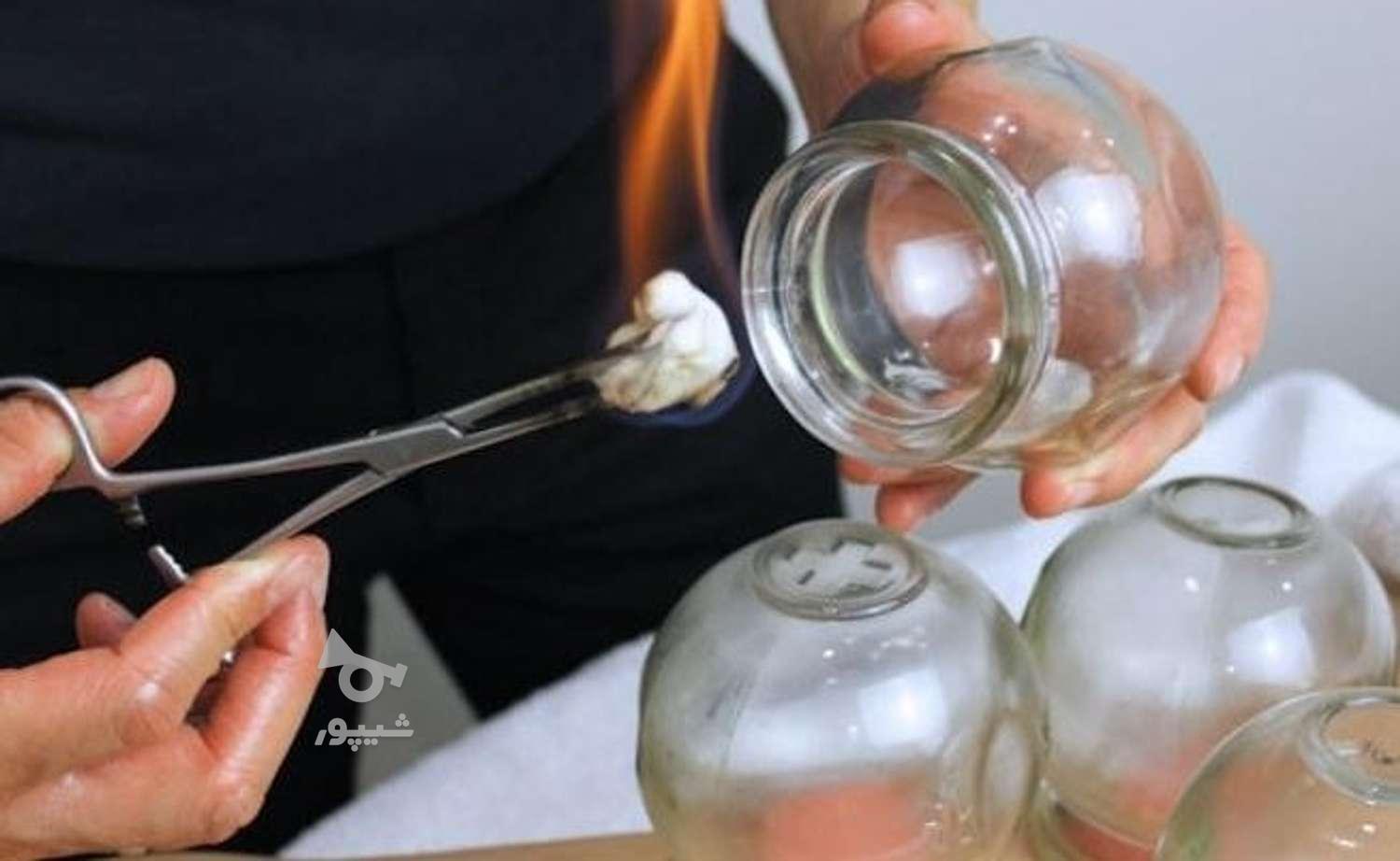 حجامت در منزل همراه با بادکش گرم و خشک و ویبره