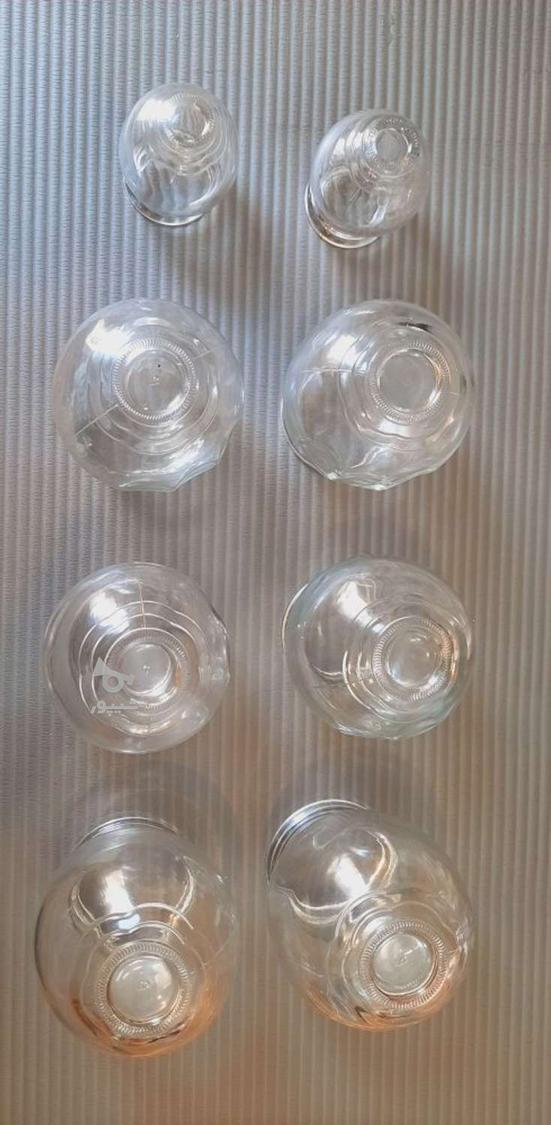 حجامت در منزل همراه با بادکش گرم و خشک و ویبره